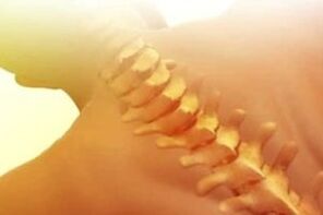 Πώς να θεραπεύσετε την οστεοχόνδρωση